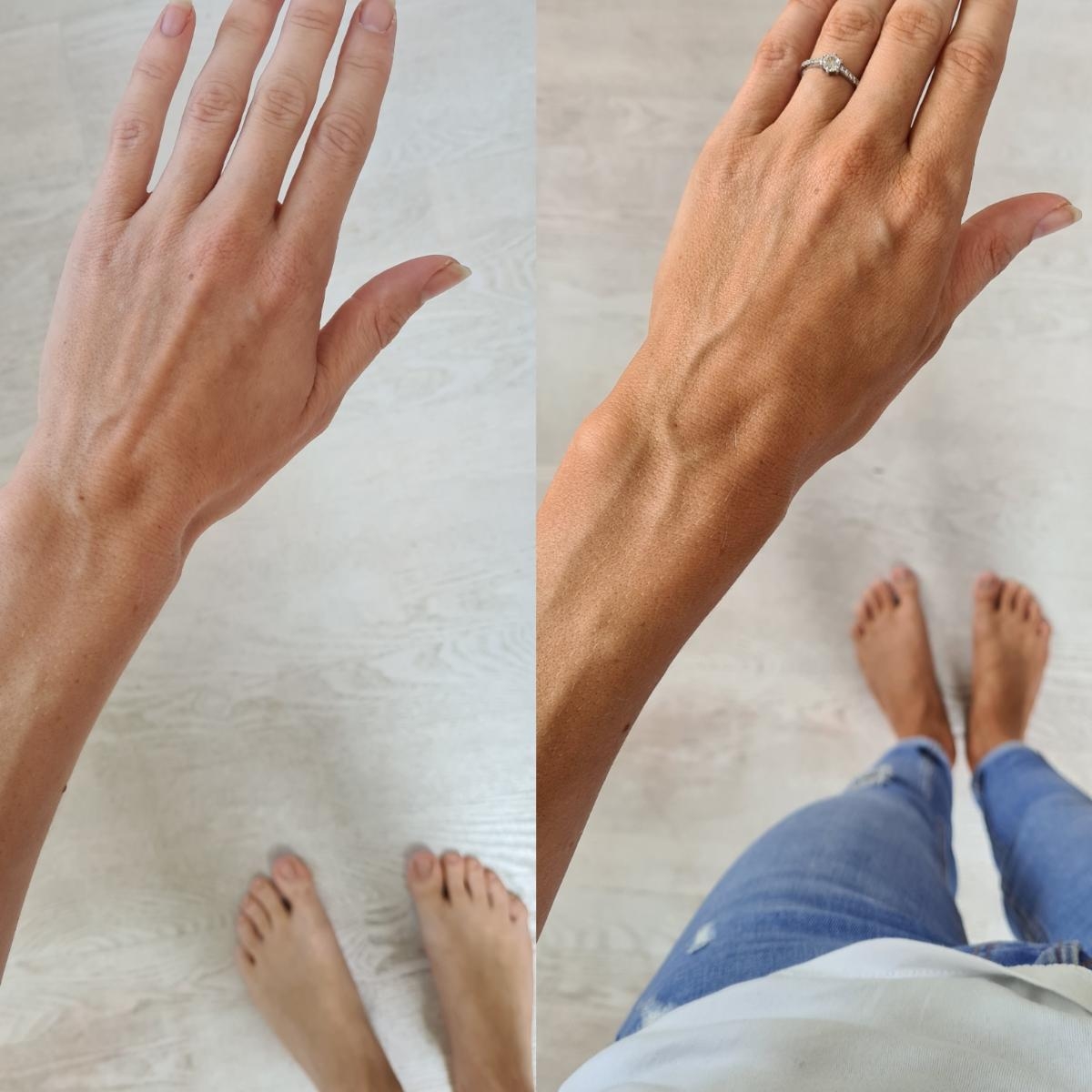 Hånd før og efter brug af Dermas Selvbrunerlotion